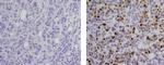 Mouse IgG2a kappa Isotype Control in Immunohistochemistry (Paraffin) (IHC (P))