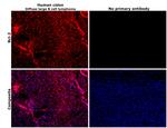 Bcl-2 Antibody in Immunohistochemistry (Paraffin) (IHC (P))