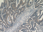 FAS/CD95 Antibody in Immunohistochemistry (Paraffin) (IHC (P))