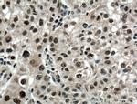 PARP1 Antibody in Immunohistochemistry (Paraffin) (IHC (P))