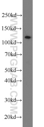 PARP1 Antibody in Western Blot (WB)