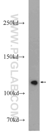 PARP1 Antibody in Western Blot (WB)