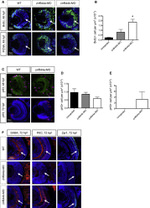 PCNA Antibody in Immunohistochemistry (IHC)