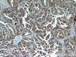 MX1 Antibody in Immunohistochemistry (Paraffin) (IHC (P))