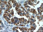 MX1 Antibody in Immunohistochemistry (Paraffin) (IHC (P))