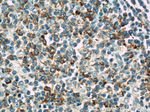 MX1 Antibody in Immunohistochemistry (Paraffin) (IHC (P))