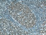 MX1 Antibody in Immunohistochemistry (Paraffin) (IHC (P))