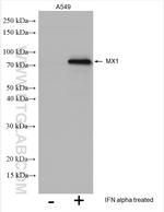 MX1 Antibody in Western Blot (WB)