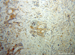 KBTBD2 Antibody in Immunohistochemistry (Paraffin) (IHC (P))