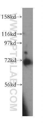 KBTBD2 Antibody in Western Blot (WB)