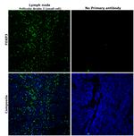 FOXP3 Antibody in Immunohistochemistry (Paraffin) (IHC (P))