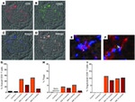 FOXP3 Antibody in Immunohistochemistry (IHC)