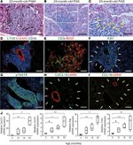 Ki-67 Antibody in Immunohistochemistry (Paraffin) (IHC (P))