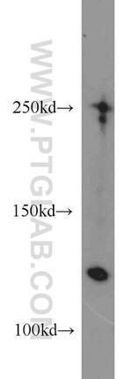 Collagen Type I Antibody in Western Blot (WB)