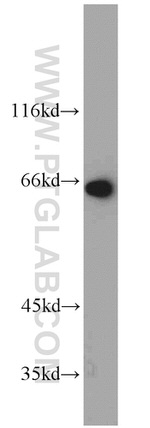 SDHA Antibody in Western Blot (WB)