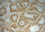 NADK Antibody in Immunohistochemistry (Paraffin) (IHC (P))