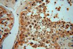 NADK Antibody in Immunohistochemistry (Paraffin) (IHC (P))