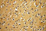 NADK Antibody in Immunohistochemistry (Paraffin) (IHC (P))