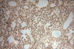 NADK Antibody in Immunohistochemistry (Paraffin) (IHC (P))