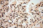 NADK Antibody in Immunohistochemistry (Paraffin) (IHC (P))