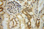 NADK Antibody in Immunohistochemistry (Paraffin) (IHC (P))