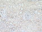 NADK Antibody in Immunohistochemistry (Paraffin) (IHC (P))