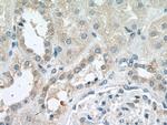 NADK Antibody in Immunohistochemistry (Paraffin) (IHC (P))