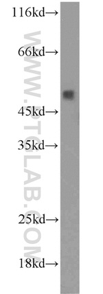 NADK Antibody in Western Blot (WB)