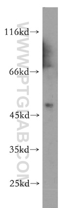 NADK Antibody in Western Blot (WB)