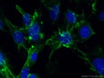 Fibronectin Antibody in Immunocytochemistry (ICC/IF)