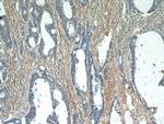 Fibronectin Antibody in Immunohistochemistry (Paraffin) (IHC (P))