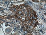 Caveolin-1 Antibody in Immunohistochemistry (Paraffin) (IHC (P))