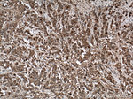 PPAR gamma Antibody in Immunohistochemistry (Paraffin) (IHC (P))