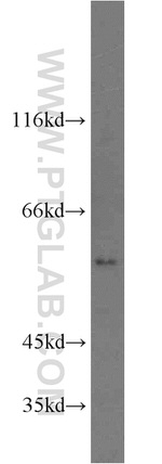 PPAR gamma Antibody in Western Blot (WB)