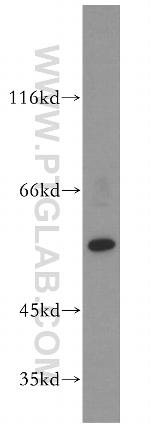 PPAR gamma Antibody in Western Blot (WB)