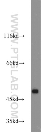 PPAR gamma Antibody in Western Blot (WB)