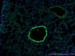 PPAR gamma Antibody in Immunohistochemistry (PFA fixed) (IHC (PFA))