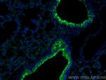 PPAR gamma Antibody in Immunohistochemistry (PFA fixed) (IHC (PFA))