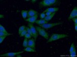 IL1 beta Antibody in Immunocytochemistry (ICC/IF)