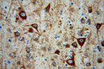 MAP2 Antibody in Immunohistochemistry (Paraffin) (IHC (P))