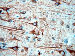 MAP2 Antibody in Immunohistochemistry (Paraffin) (IHC (P))