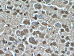 ARL13B Antibody in Immunohistochemistry (Paraffin) (IHC (P))