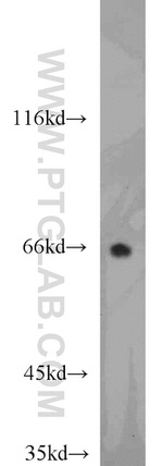 ARL13B Antibody in Western Blot (WB)