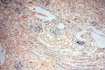 P2RY1 Antibody in Immunohistochemistry (Paraffin) (IHC (P))