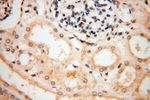 P2RY1 Antibody in Immunohistochemistry (Paraffin) (IHC (P))