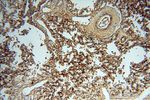 P2RY1 Antibody in Immunohistochemistry (Paraffin) (IHC (P))