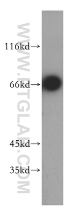 P2RY1 Antibody in Western Blot (WB)