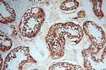 P2RY1 Antibody in Immunohistochemistry (Paraffin) (IHC (P))