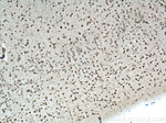 iNOS Antibody in Immunohistochemistry (Paraffin) (IHC (P))