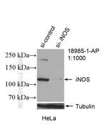 iNOS Antibody in Western Blot (WB)